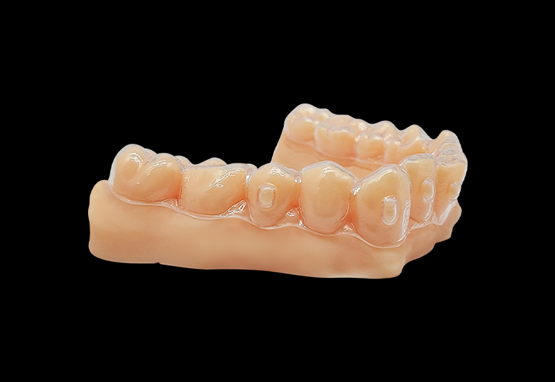 什么是3d打印正畸牙模？3d打印正畸牙模怎么做？